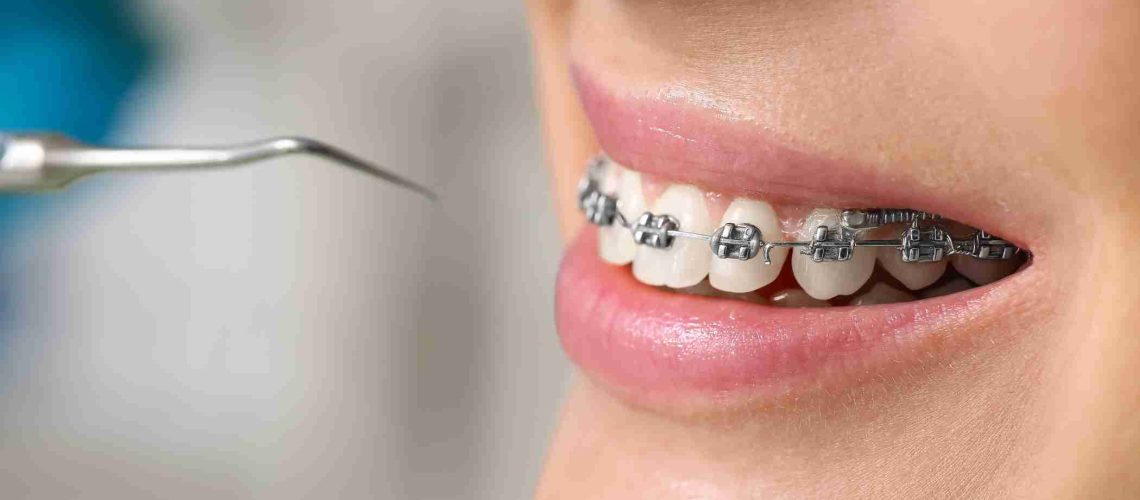 Planejamento Tributário para Dentistas